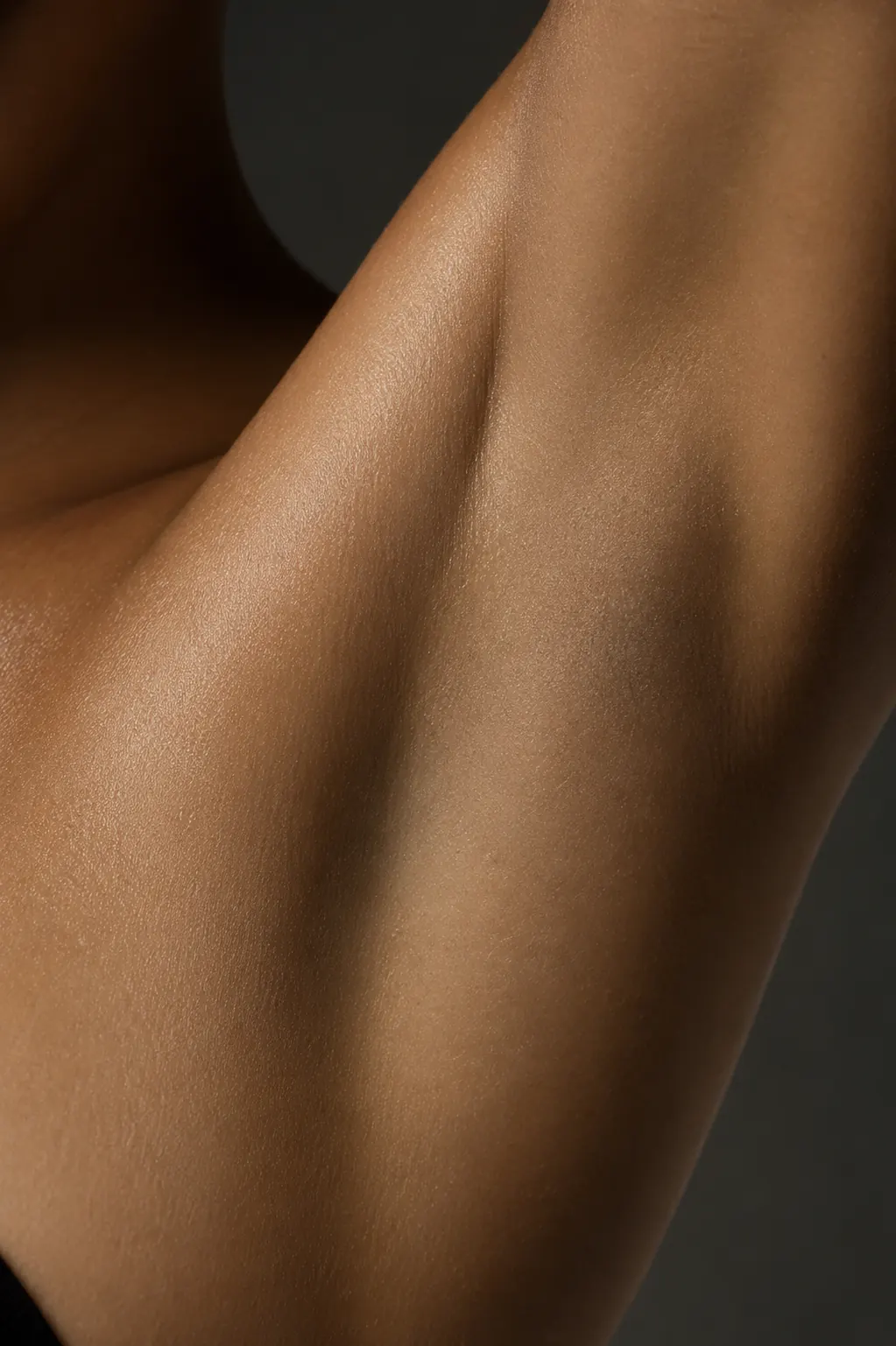 BOTOX FOR HYPERHIDROSIS