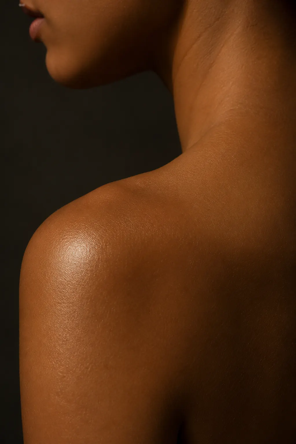 TRAPEZIUS BOTOX